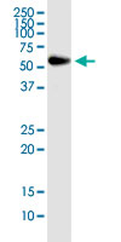 RNPS1 monoclonal antibody (M05), clone 7G8