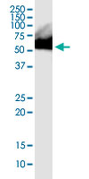 RNPS1 monoclonal antibody (M05), clone 7G8