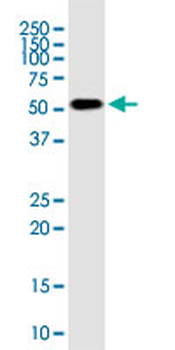 RNPS1 monoclonal antibody (M05), clone 7G8