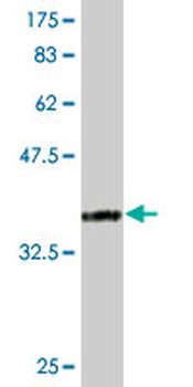 RNPS1 monoclonal antibody (M05), clone 7G8