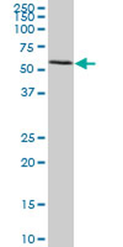 FGL2 monoclonal antibody (M02), clone 5A10
