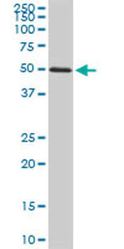 FGL2 monoclonal antibody (M02), clone 5A10