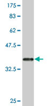 FGL2 monoclonal antibody (M02), clone 5A10