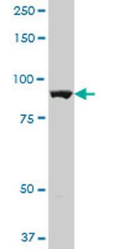 ALDH1L1 polyclonal antibody (A01)
