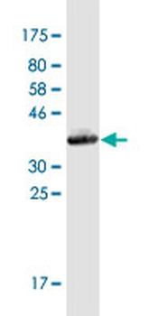 SEC24A monoclonal antibody (M01), clone 4D9