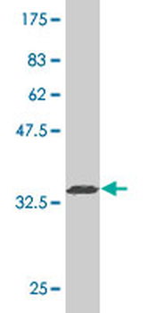 SEPT9 monoclonal antibody (M01), clone 2C6