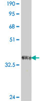 SEPT9 polyclonal antibody (A01)