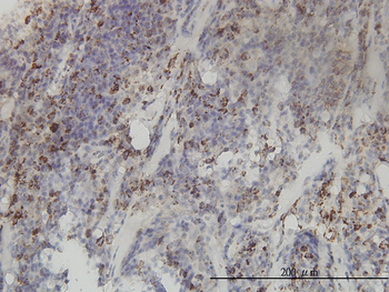 MTHFD2 monoclonal antibody (M01), clone 4G7-2G3