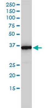 MTHFD2 monoclonal antibody (M01), clone 4G7-2G3