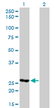 MTHFD2 monoclonal antibody (M01), clone 4G7-2G3