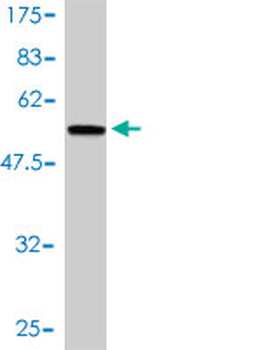 MTHFD2 monoclonal antibody (M01), clone 4G7-2G3