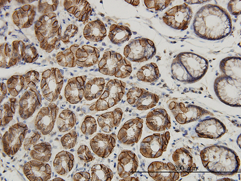 AHCYL1 monoclonal antibody (M05), clone 5D6