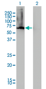 AHCYL1 monoclonal antibody (M05), clone 5D6