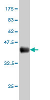 AHCYL1 monoclonal antibody (M05), clone 5D6