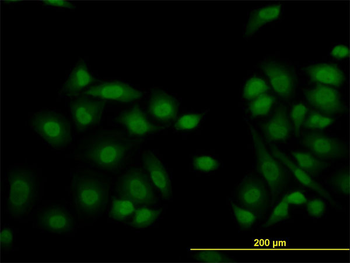 KDM5B monoclonal antibody (M02), clone 1G10