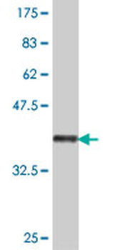 CHL1 polyclonal antibody (A01)