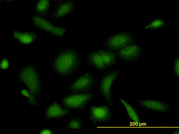 NUDC monoclonal antibody (M01), clone 5G12