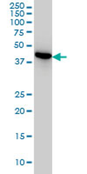 NUDC monoclonal antibody (M01), clone 5G12