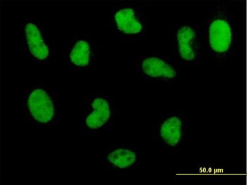 POLD3 monoclonal antibody (M01), clone 3E2