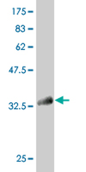 KLF1 monoclonal antibody (M02), clone 4E10