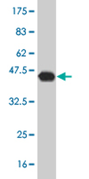 CAMKK2 monoclonal antibody (M01), clone 1A11