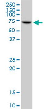 IGF2BP2 monoclonal antibody (M01), clone 4C6