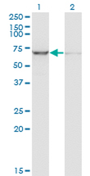 IGF2BP2 monoclonal antibody (M01), clone 4C6