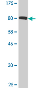 IGF2BP2 monoclonal antibody (M01), clone 4C6