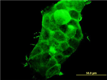 PDLIM5 monoclonal antibody (M01), clone 3E11-F6