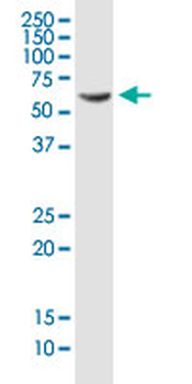 PDLIM5 monoclonal antibody (M01), clone 3E11-F6