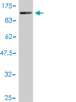 PDLIM5 monoclonal antibody (M01), clone 3E11-F6