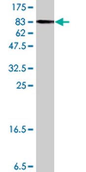 PDLIM5 polyclonal antibody (A02)