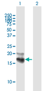 NPC2 purified MaxPab mouse polyclonal antibody (B01P)