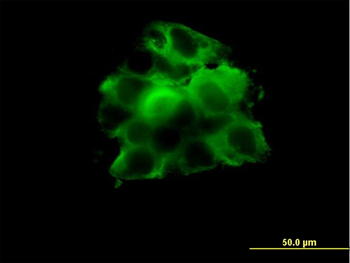 CCT2 monoclonal antibody (M01), clone 2G6