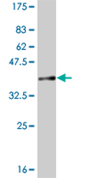 CCT2 monoclonal antibody (M01), clone 2G6