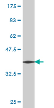 CCT7 monoclonal antibody (M02), clone 3A6