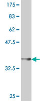 DPYSL4 polyclonal antibody (A01)