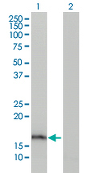 AGR2 monoclonal antibody (M03), clone 1C3