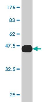 AGR2 monoclonal antibody (M03), clone 1C3