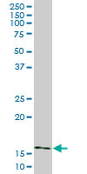 AGR2 monoclonal antibody (M01), clone 1E5