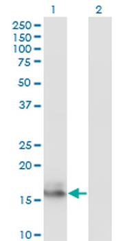 AGR2 monoclonal antibody (M01), clone 1E5