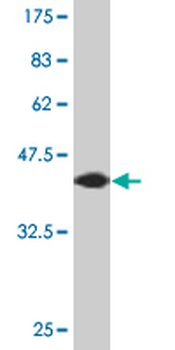 AGR2 monoclonal antibody (M01), clone 1E5