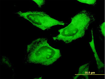PROCR monoclonal antibody (M03), clone M2