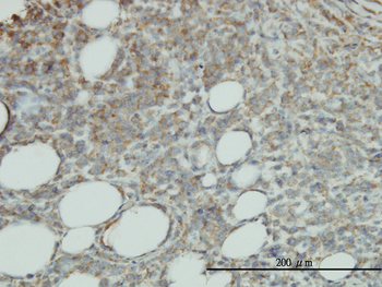 PROCR monoclonal antibody (M03), clone M2