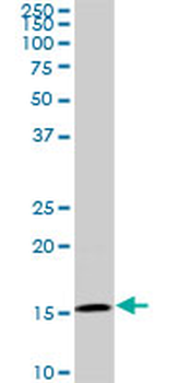 BATF monoclonal antibody (M03), clone 1G4