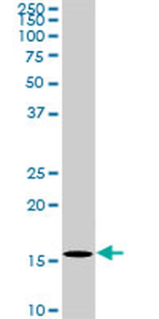 BATF monoclonal antibody (M03), clone 1G4