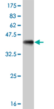 BATF monoclonal antibody (M03), clone 1G4