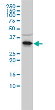 RNASEH2A monoclonal antibody (M01), clone 3G5-F5
