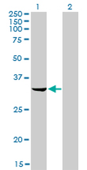 RNASEH2A monoclonal antibody (M01), clone 3G5-F5