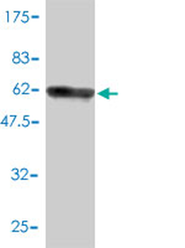 RNASEH2A monoclonal antibody (M01), clone 3G5-F5